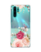Hey Casey! Lardy-Dardy Phone Case for iPhone Samsung Huawei