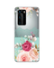Hey Casey! Lardy-Dardy Phone Case for iPhone Samsung Huawei